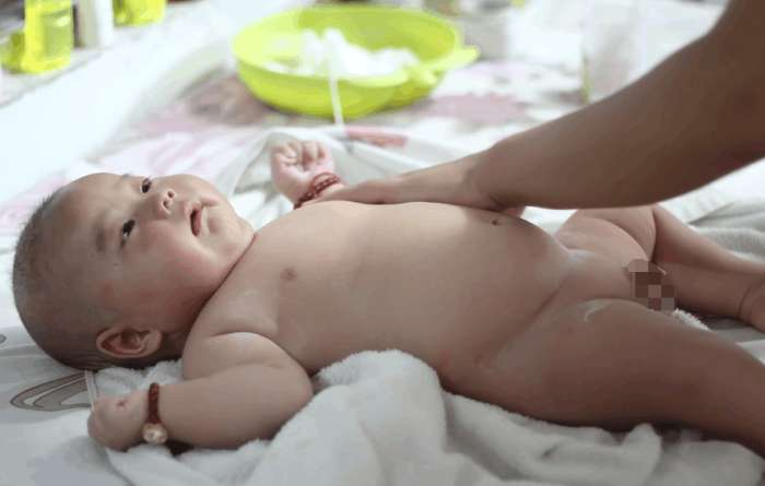 3个月的小宝宝容易长湿疹,刚出生宝宝一脸湿疹