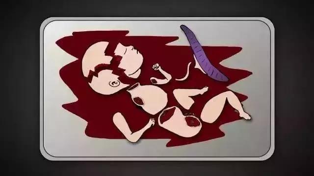 流产和宫外孕哪个可怕,流产跟怀孕有什么关系