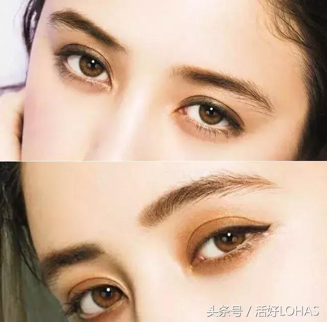 拯救发际线的生发神器,拯救发际线神器