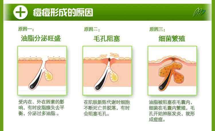 面部痘痘认知,痘痘的认知