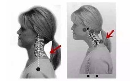 拉伸脖子肌肉瑜伽动作,脖子越来越粗背越来越厚的原因