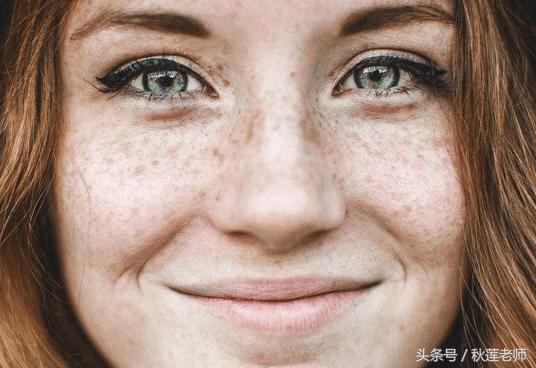 长雀斑是什么原因引起的怎么预防,雀斑是怎么形成的怎样淡化雀斑