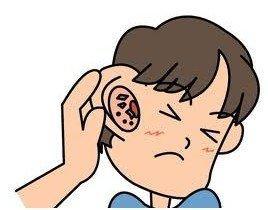 滴鼻液治疗中耳炎正确的滴法,鼻喷剂治疗中耳炎靠谱吗