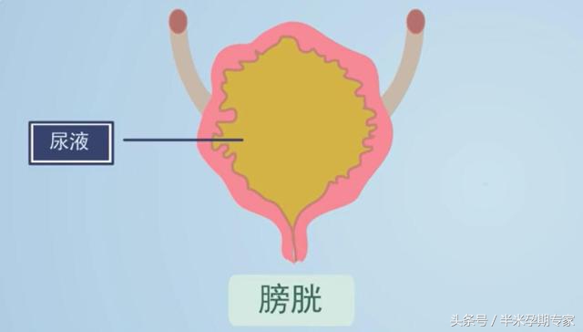 产后尿潴留插管后能自愈吗,产后尿潴留针灸