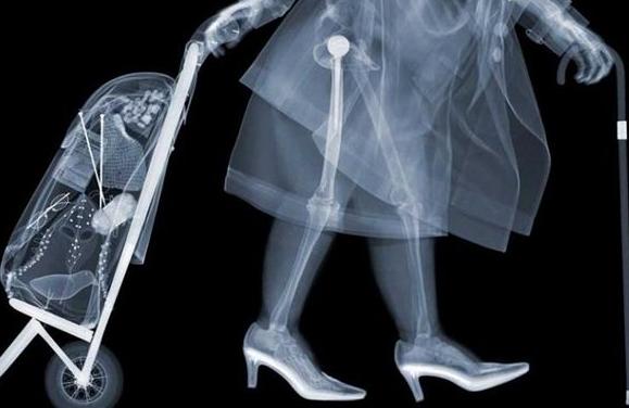 x光ct和核磁共振b超的区别,x光ct磁共振b超有什么区别