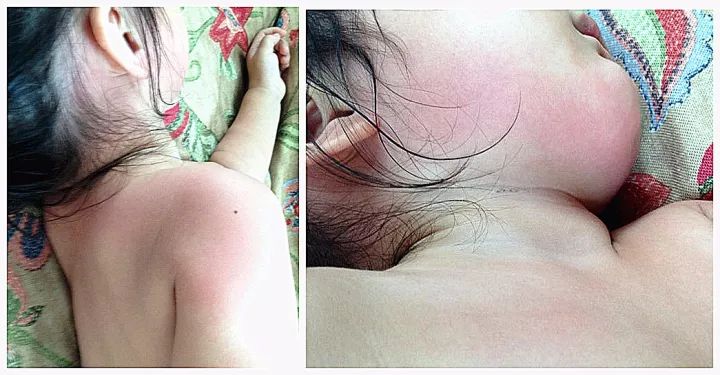 板蓝根可以与小柴胡一起使用吗,小柴胡颗粒使用说明书