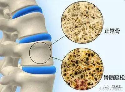 一文看懂慢性病,一文读懂疾病介绍