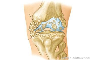 大病先兆自查表全文,大病先兆自查表格