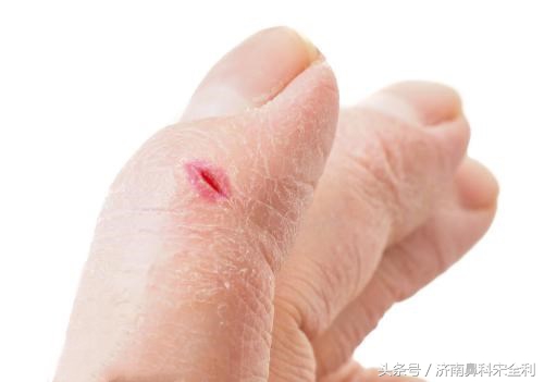 三甲医院通用的《疾病先兆自查表》，我用了几十年，现在还在用！