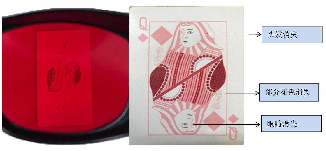 郑大夫斜弱视,郑医生配镜价格