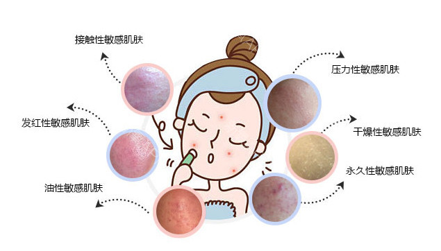 我的皮肤比较敏感用什么护肤品,我的皮肤用任何产品都过敏怎么办