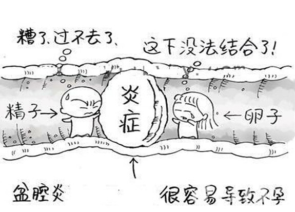 听说你是盆腔炎?很可能你被过度诊断和治疗