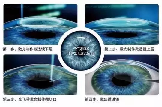 刘烨的眼睛怎么那么好看,刘烨的眼睛为什么好看