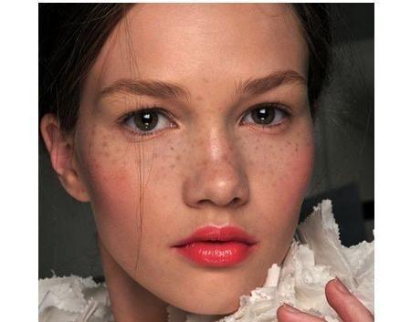 孕期变黑长斑怎么回事,孕期祛黑斑最好方法