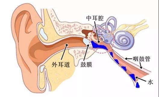 宝宝说耳朵疼有哪些原因,儿童感冒耳朵疼中耳炎怎么缓解