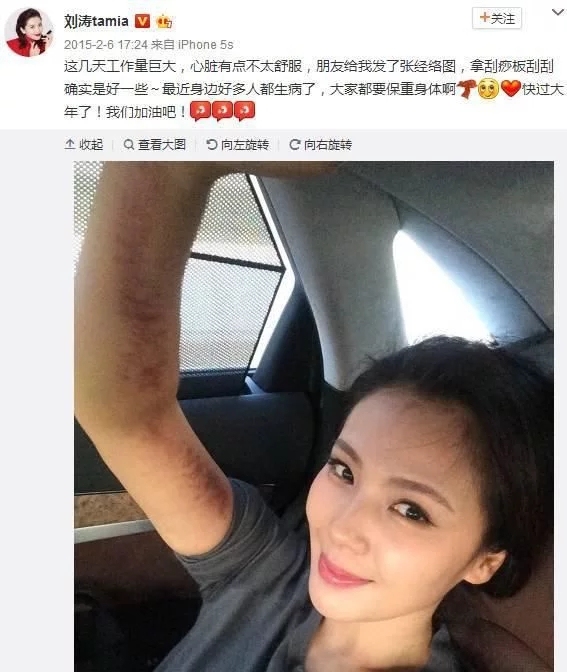 让众多明星痴迷的神秘东方医术!快来get明星同款!