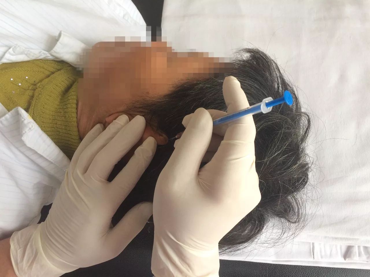 神医用一根针就治好了病,一根针救活一个人原版