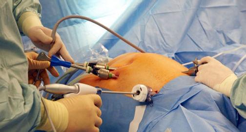 食道贲门癌能治好吗,贲门癌中药能治好吗