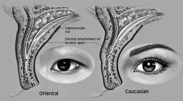 哭的时候会变双眼皮,哭多了眼睛会变双眼皮吗