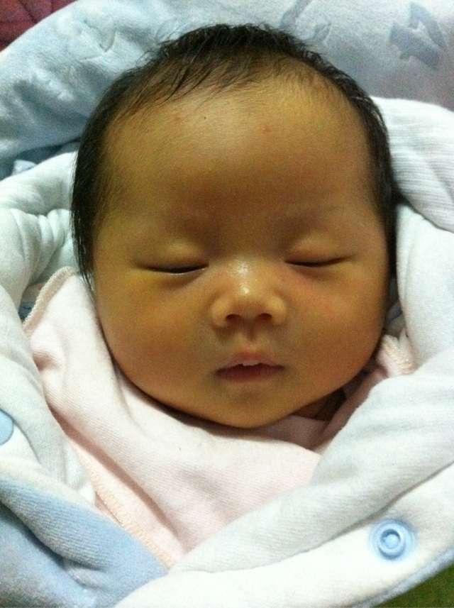 新生儿黄疸的那些事儿要知道,宝妈应该知道的新生儿黄疸小知识