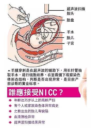 啊，肚子会被刺穿么？别担心，一分钟带你看懂羊膜穿刺