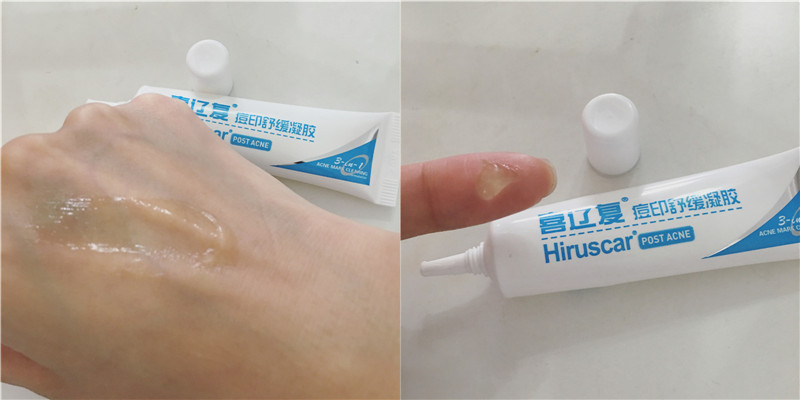 快速祛痘印小技巧,小妙招帮你祛痘印视频