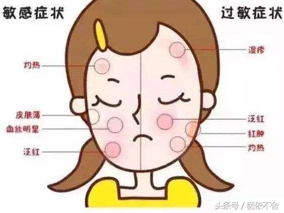 化妆品过敏是哪种皮炎,化妆品皮炎是怎么预防