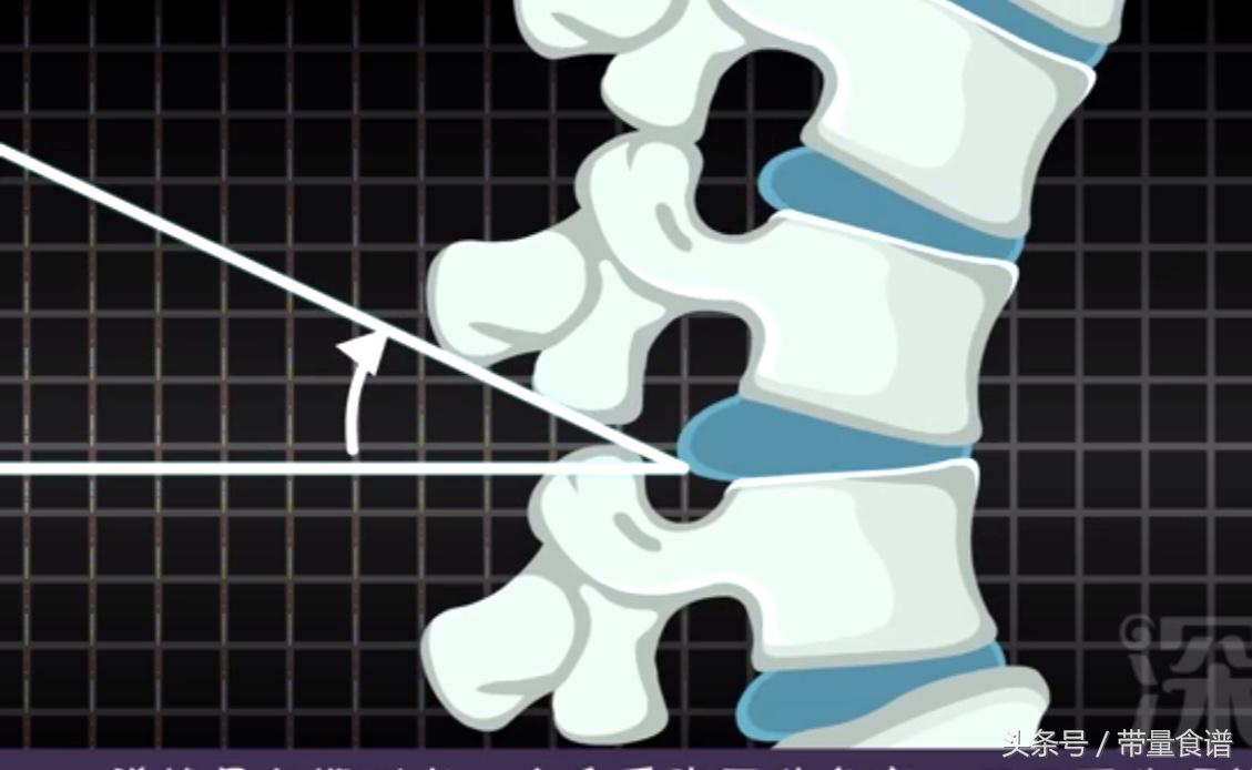 坐不久就腰痛怎么回事,坐着的时候腰椎间盘突出