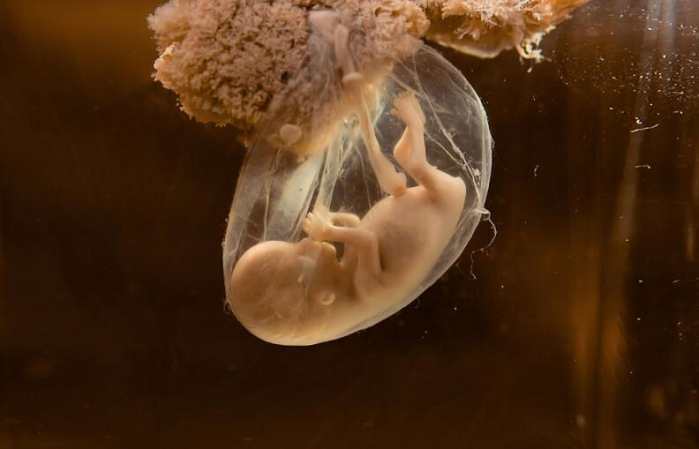 胎盘老化是什么原因,40周胎盘老化严重吗