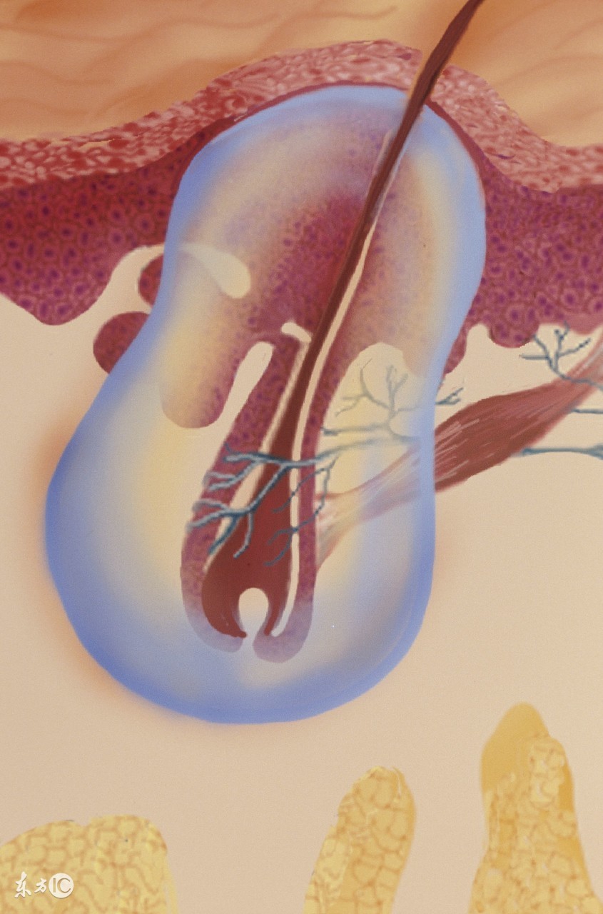 有什么偏方治疗毛囊炎,头皮毛囊炎的饮食调理与禁忌