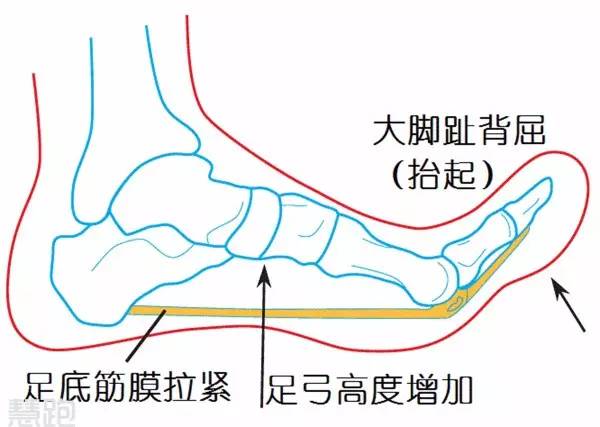 全球治好足跟痛,足底疗法治百病