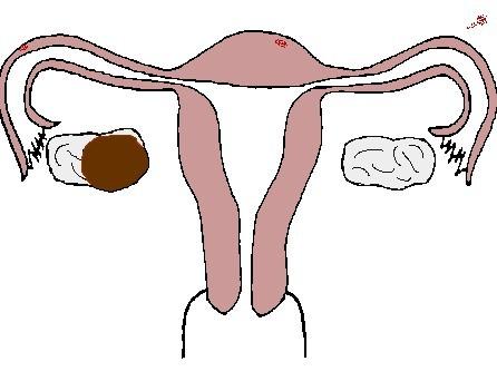 b超排卵监测准确吗,排卵监测有什么作用