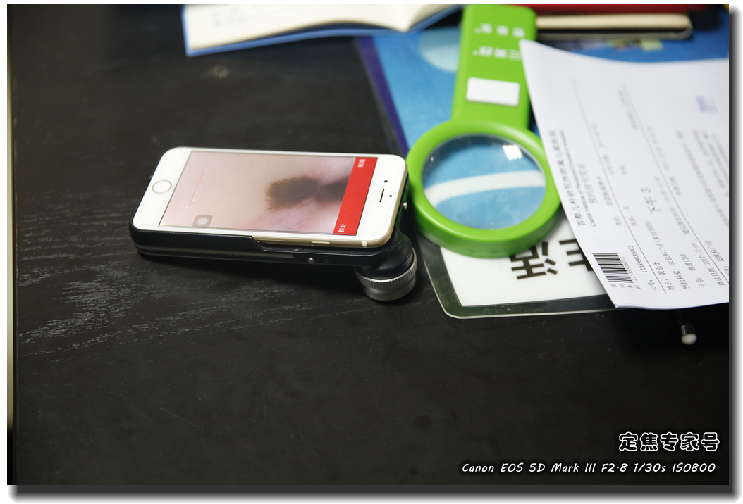 皮肤专家诊室故事连载之四，胳膊上一个小硬块能掏出多少东西？