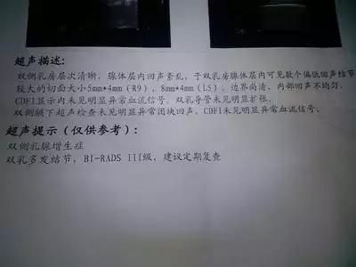 乳腺b超报告单模板,乳腺增生b超报告单表述