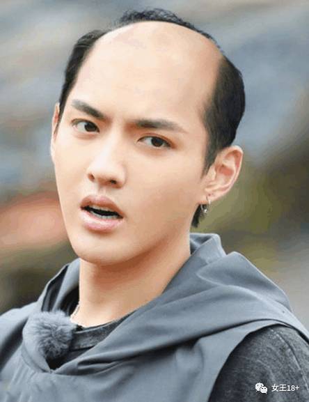 男生防止发际线后移的方法,男性怎样防止发际线后移