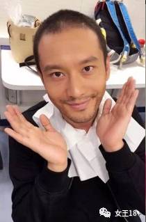 男生防止发际线后移的方法,男性怎样防止发际线后移