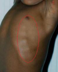 怎么查小月龄宝宝缺不缺维生素d,宝宝冬季怎么补充维生素