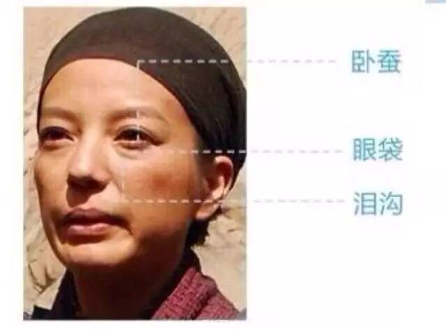 眼纹一招搞定,别让眼纹透露你的年龄