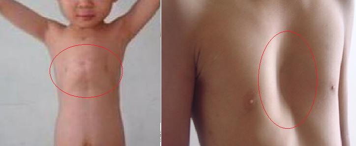 怎么查小月龄宝宝缺不缺维生素d,宝宝冬季怎么补充维生素