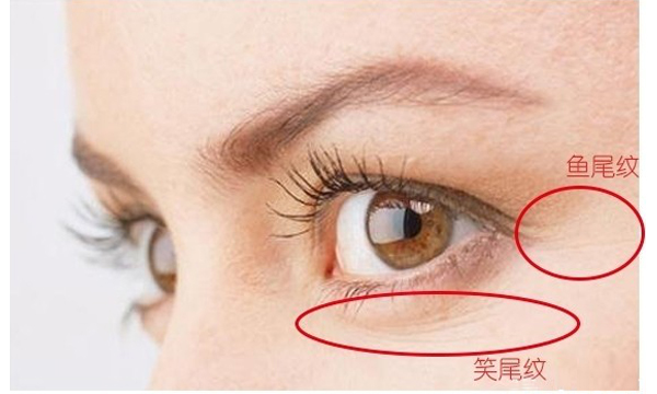 眼霜去眼纹鱼尾纹,去鱼尾纹眼纹最强的眼霜