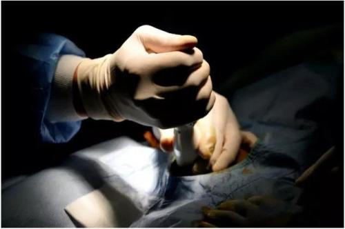 被忽悠割了包皮,包皮被忽悠割了