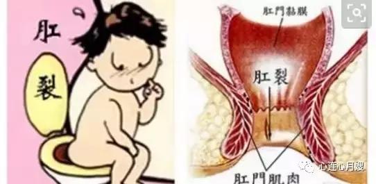 儿童便血吓坏了,小孩便血是小肠原因吗