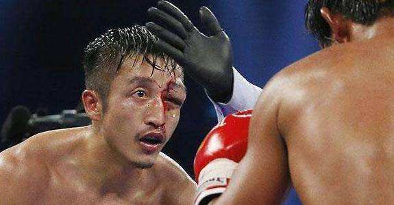 邹市明拳击比赛被打得最惨,邹市明拳击最惨败的一次