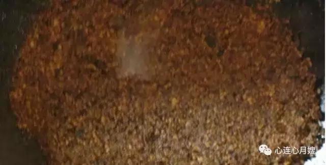 儿童便血吓坏了,小孩便血是小肠原因吗