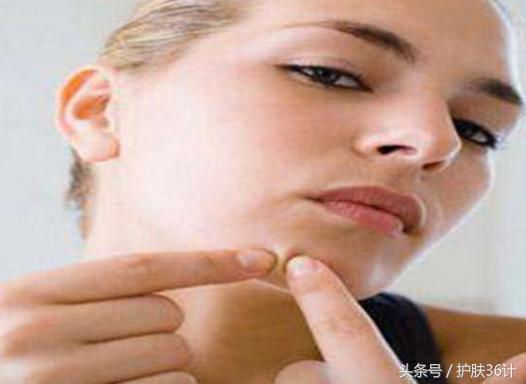 嘴唇周围长痘吃什么最好,鼻子嘴唇周围长痘痘是什么原因