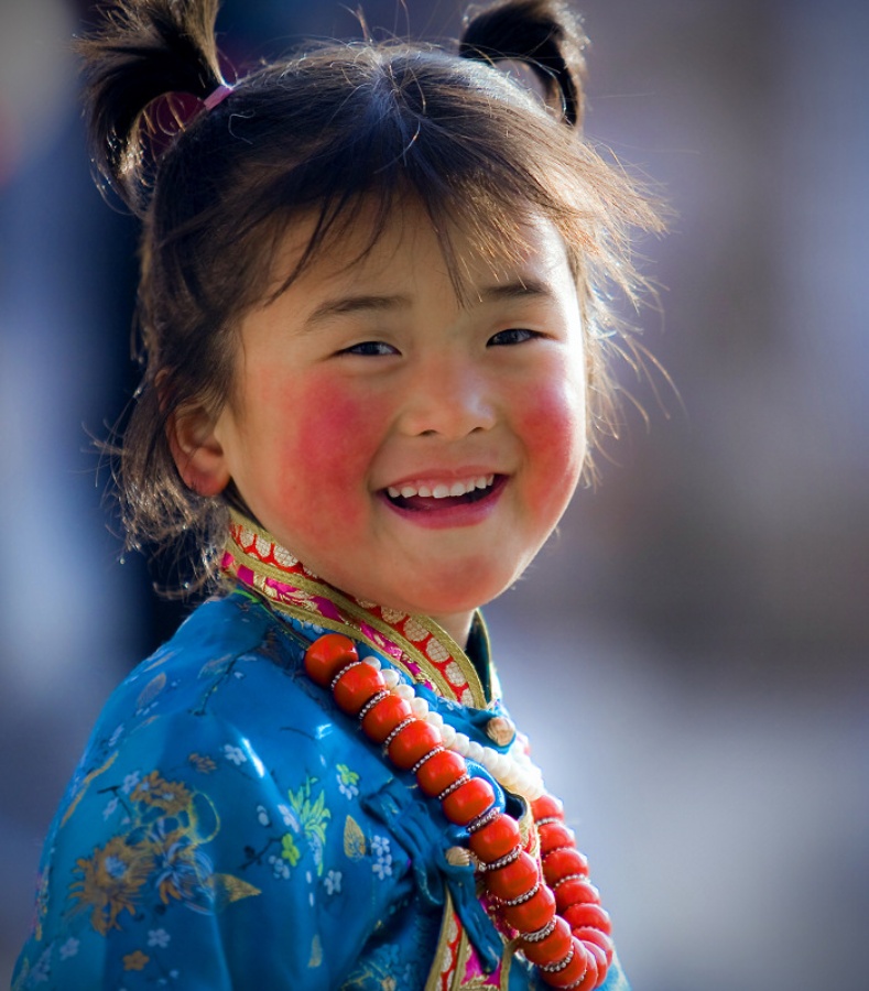 面部红血丝用什么可以彻底消除,怎样才能有效去除面部红血丝