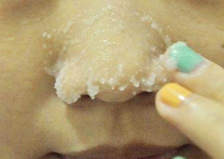 祛黑头最快最好的土方法,老中医去黑头的药膏