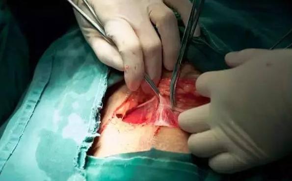 经历了剖腹产才知道妈妈的不容易,看了剖腹产才明白妈妈是多么伟大