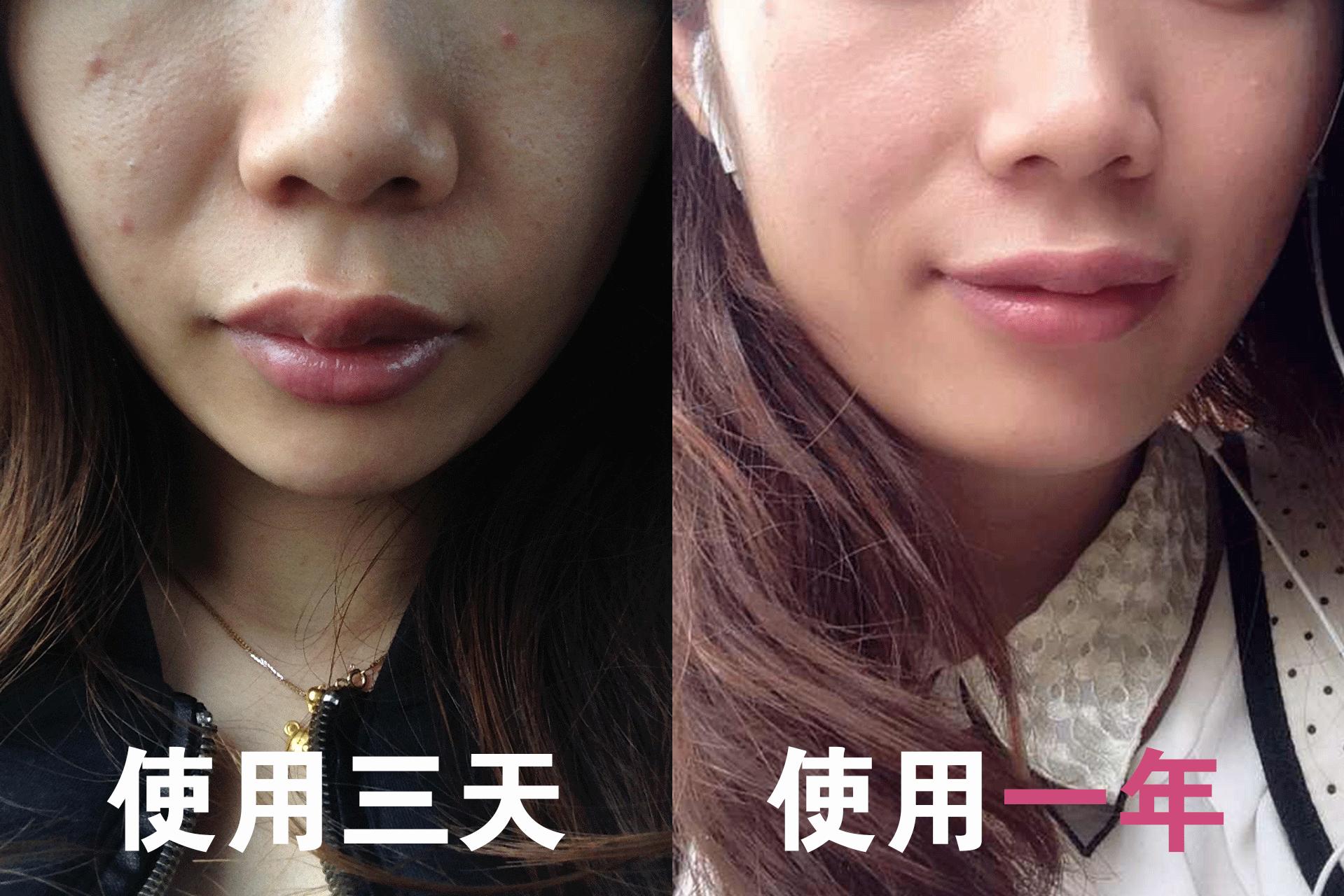 皮肤科博士护肤保养经验心得,一篇文章的心得怎么写