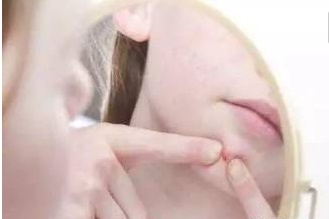 成人痘和青春痘的区别,有痘痘的人要怎么治